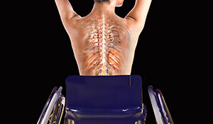 Spinal Cord Rehabilitation Course