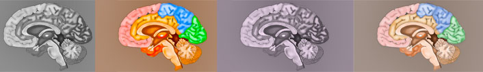 Three types of ischemic strokes