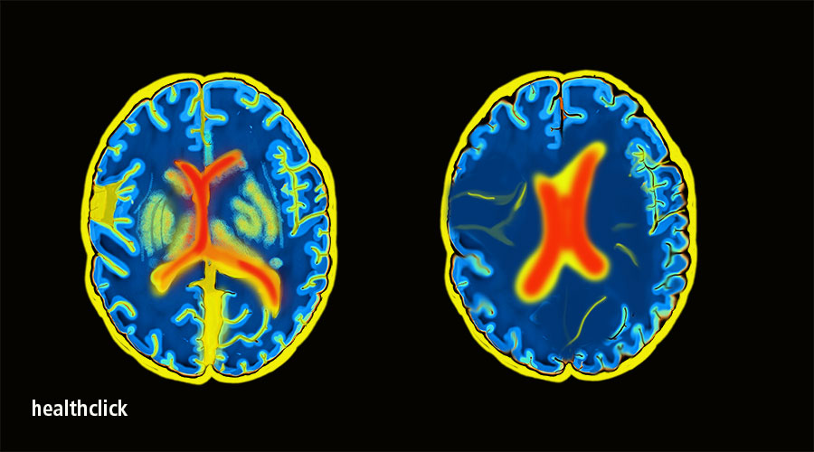 Sports Concussions and the Oculomotor System PT CE Cours